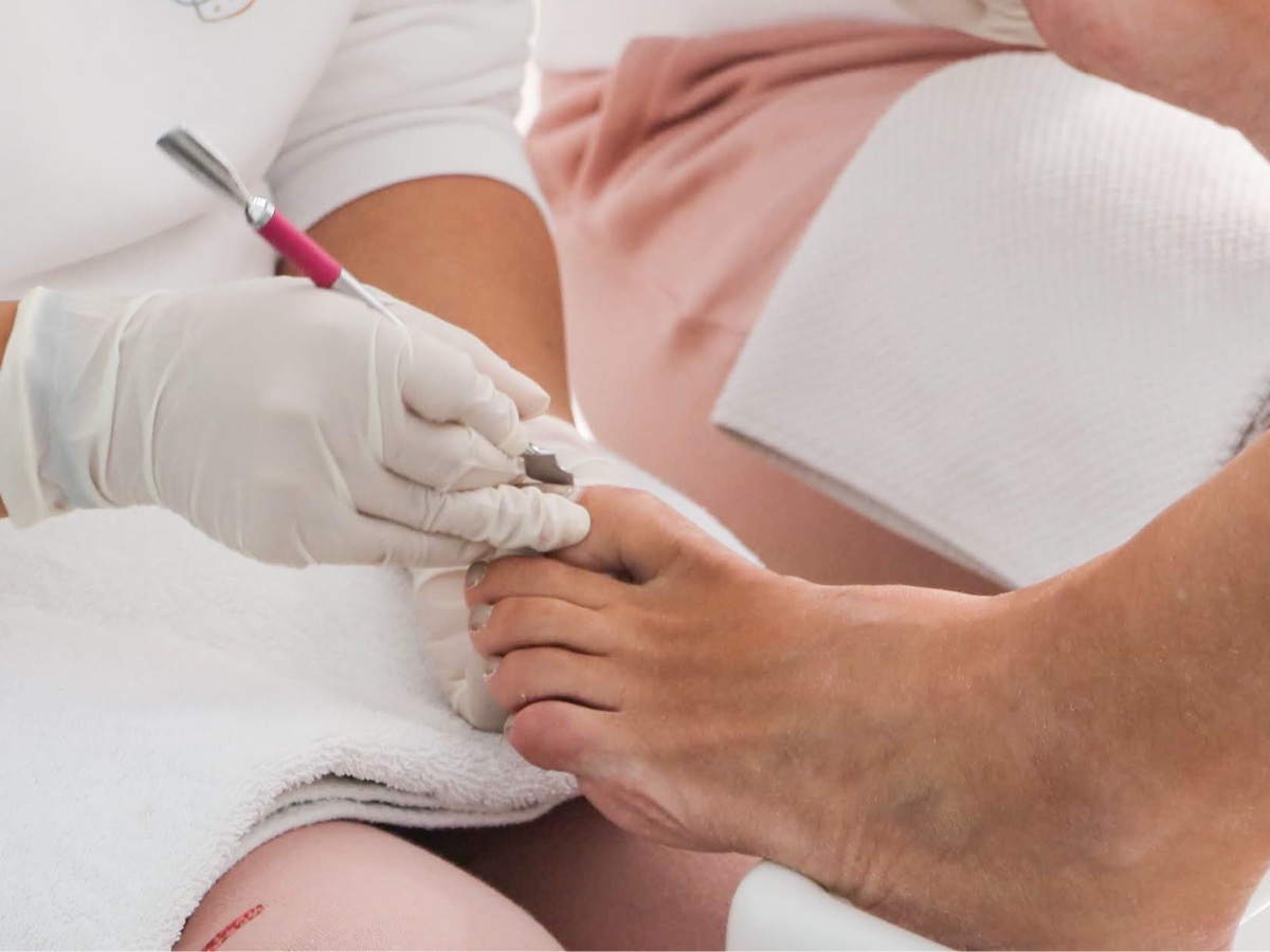 Medisch pedicure behandeling